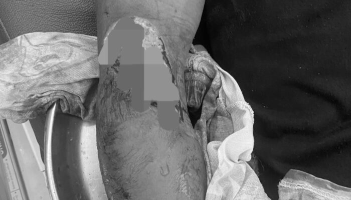 Pemuda Dibacok Pelaku PETI di Popayato Barat, Polisi Masih Bungkam